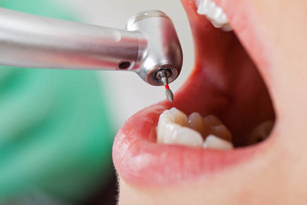 Best Emergency Treatment for Oral Infections in Lathrop, MO